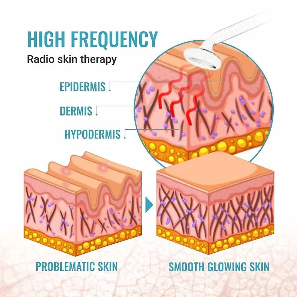 GESS SuperNova Darsonval Hochfrequenzgerät für Gesicht und Haare, Anti Aging Gesichtsmassagegerät, Akne Behandlung, Faltenreduzierung, Hautpflege Kosmetik Gerät