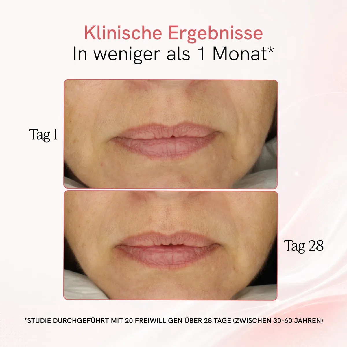 MASDERM | Professionelles 5-in-1 Radiofrequenz-Gesichtsgerät | Ultraschall für das Gesicht | Gesichtsmassagegerät | Anti-Falten-Gerät | straffende Galvanik Gesicht | Hohe Frequenz | Hochfrequenz