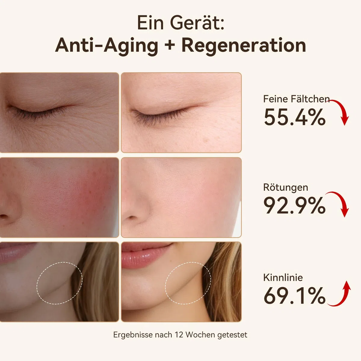 ANLAN EMS Gesichtsmassagegerät, Radiofrequenz mit 3 Vibrationsstufen & Phototherapie Gerät Gesicht Massagegerät, Anti-Falten Gesichtsmassagegerät für Gescht/Hals, Reduziert Schwellungen & Falten Firm