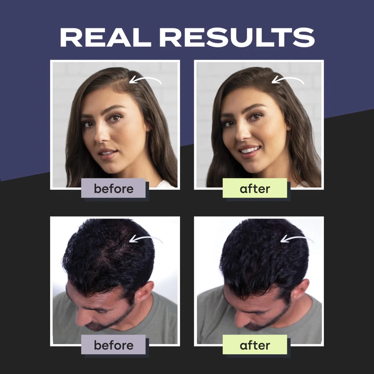 Toppik Haarfasern zur Haarverdichtung, Ansatzpuder und Streuhaar für Haarausfall und sofort volleres Haar, kaschiert lichte Stellen, natürlicher Look, einfach anzuwenden, Schwarz, 55g
