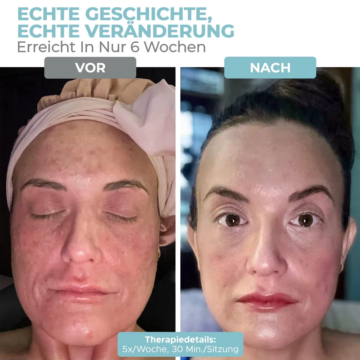 Nourished Bodynskin LED Lichttherapie Gesichts- & Halsmaske - Gesichtspflegegerät - 7 Farben Rot & Blau - Verjüngung, Anti-Aging-Produkt gegen Falten