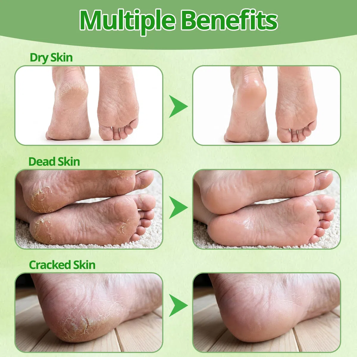 9 Pack Fußmaske Gegen Hornhaut, Hornhaut Socken für Damen Herren | Fussmaske Hornhautentfernung, Hornhautentferner Socken zur Feuchtigkeitspflege, Beruhigung(Lavendel, Aloe Vera, Avocado)