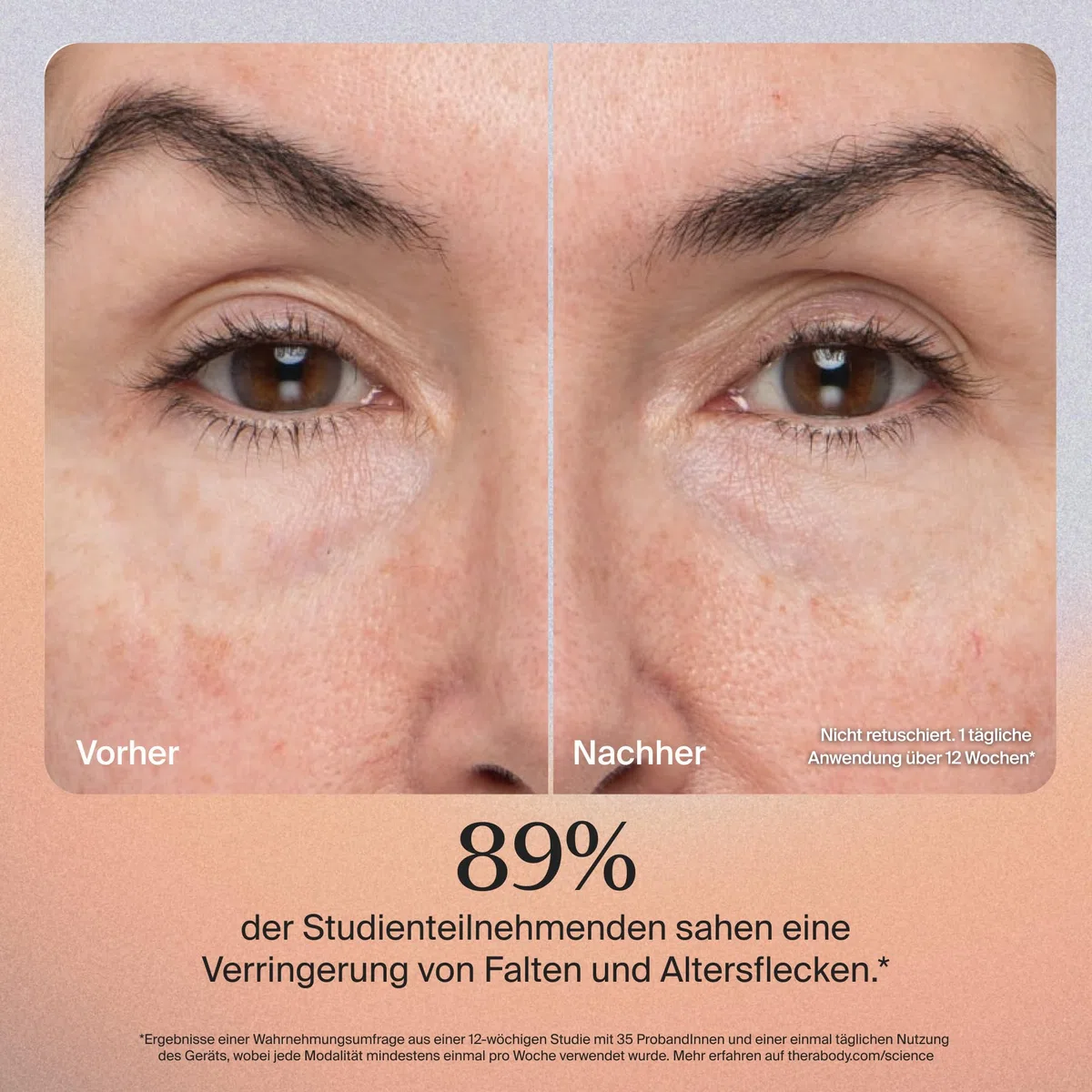 TheraFace PRO – Handgerät zur Gesichtsmassage – Kompaktes elektrisches Gerät zur Gesichts- und Hautpflege – 8-in-1-Behandlung mit Mikrostrom- und LED-Ringen – 4. Generation – Schwarz