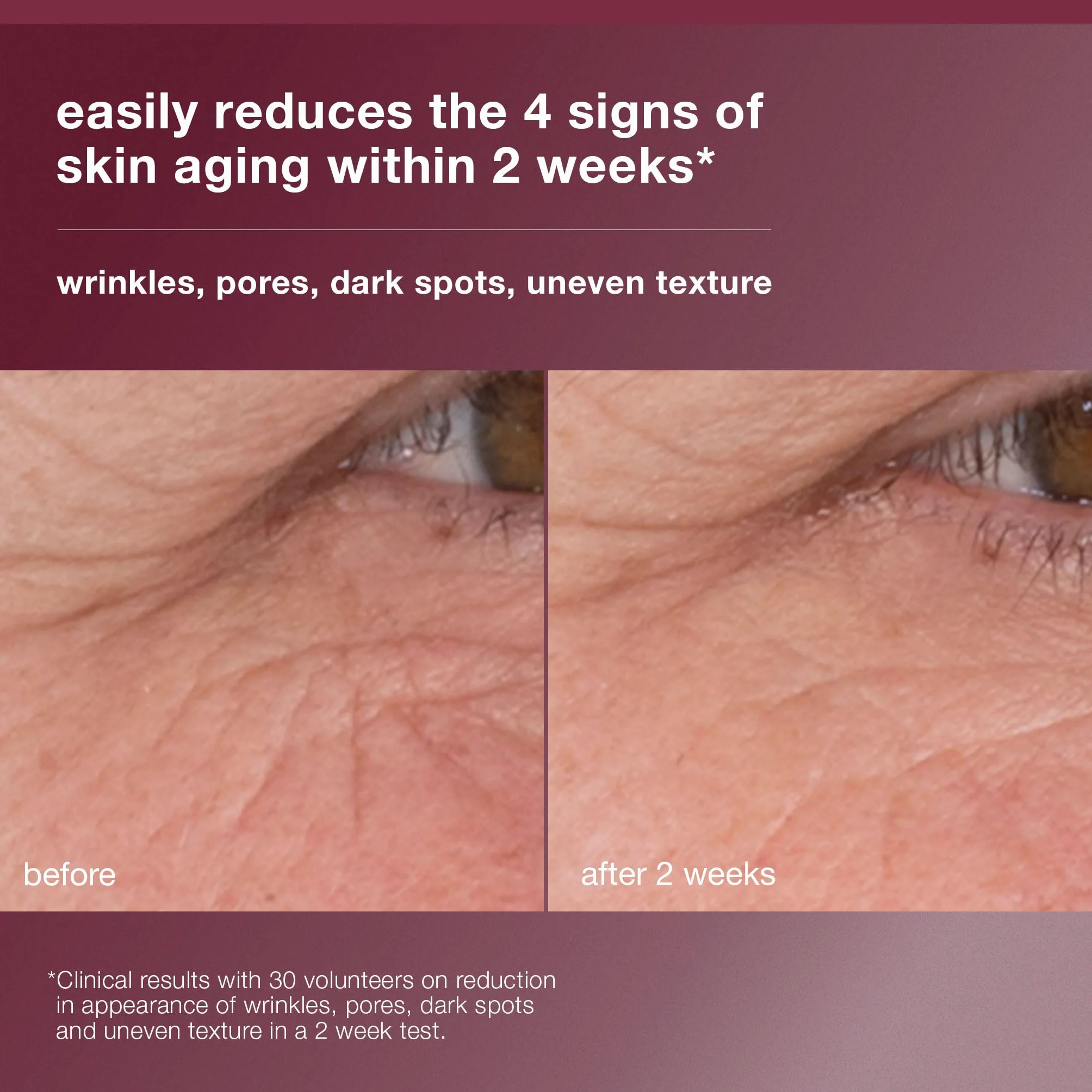 Dermalogica Dynamic Skin Retinol Serum gegen Fältchen | Retinolserum, das Hautstruktur und Poren verfeinert und feine Linien sichtbar mindert.
