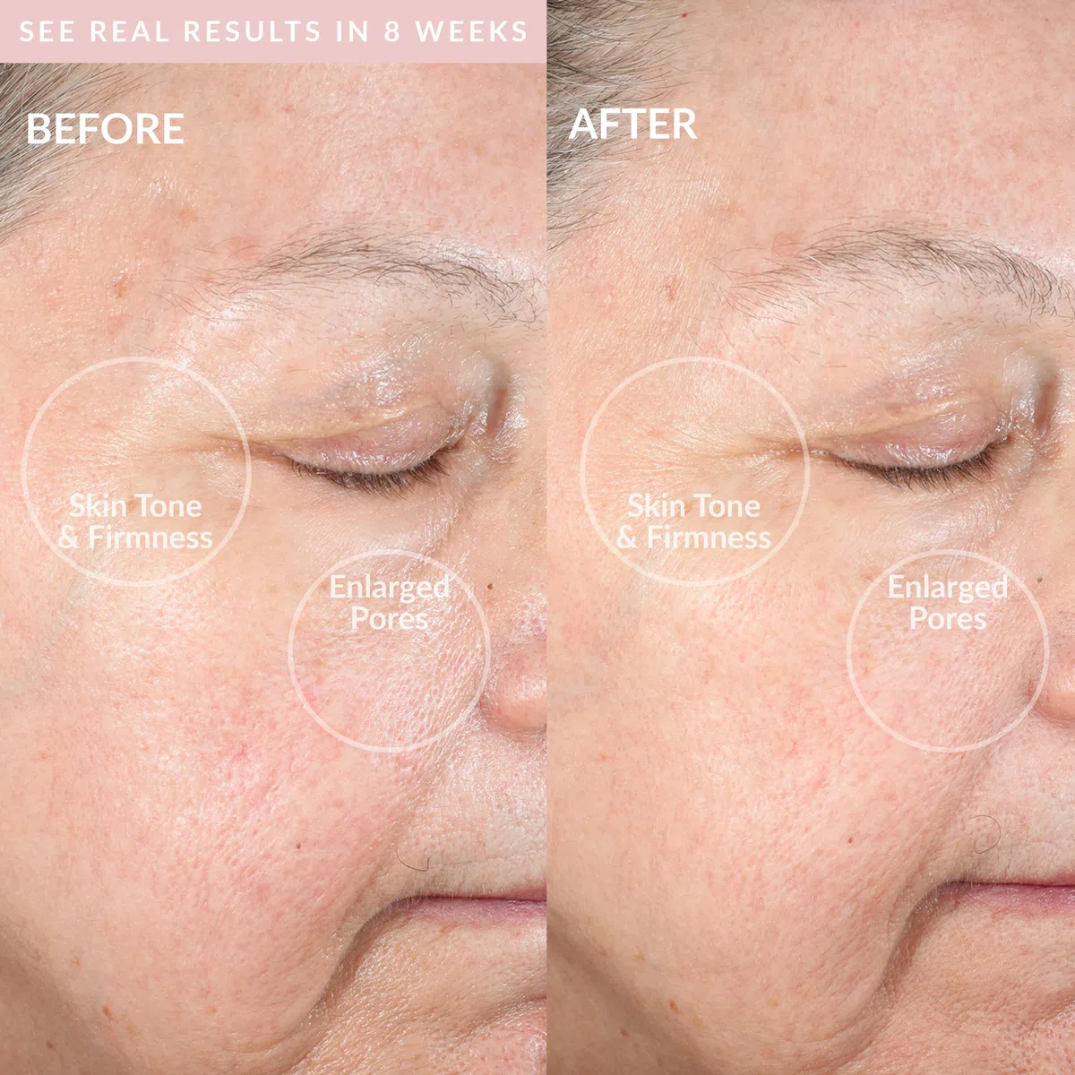PMD Beauty Sauber Pro RQ Gesichtsbehandlung Reinigend Gerät, Erröten, 320 g